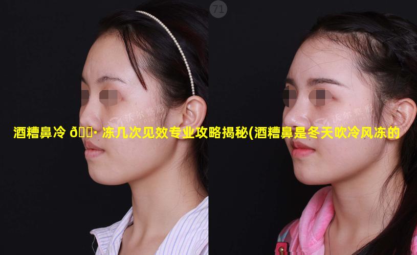 酒糟鼻冷 🕷 冻几次见效专业攻略揭秘(酒糟鼻是冬天吹冷风冻的吗)